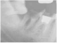 wpe4.jpg (2575 �o�C�g)